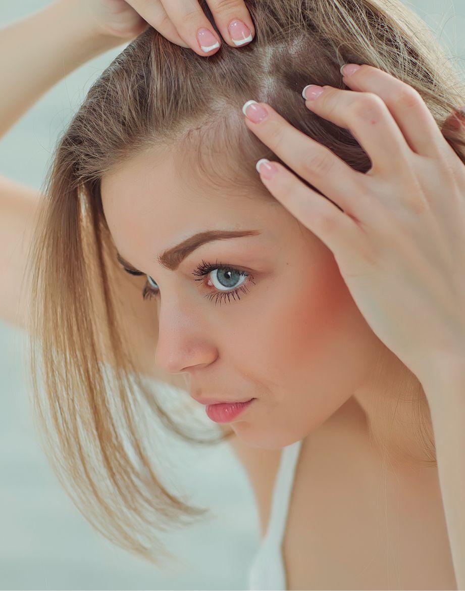 Hair Transplant For Women