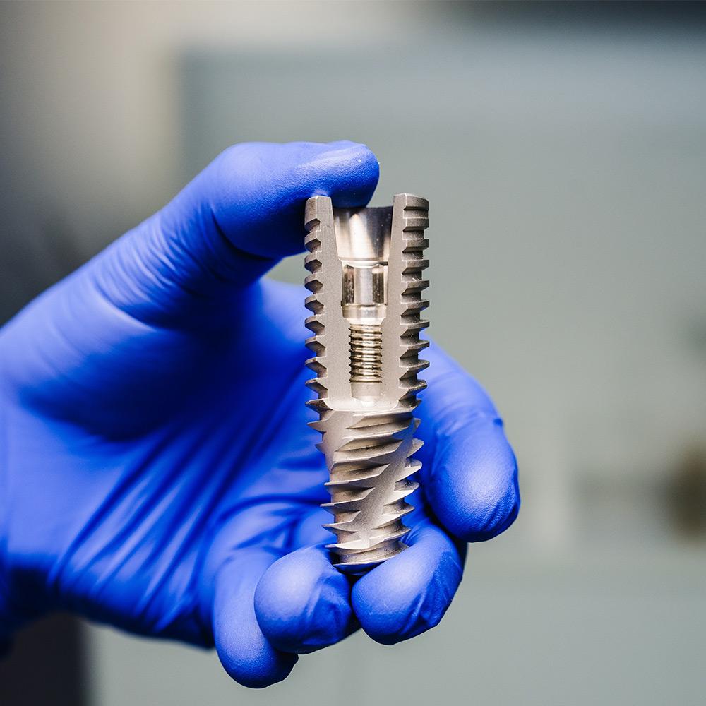 dental implant