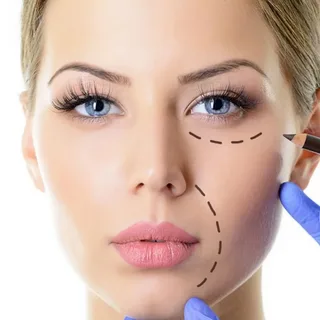 Blepharoplasty Detail