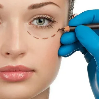 Blepharoplasty Detail