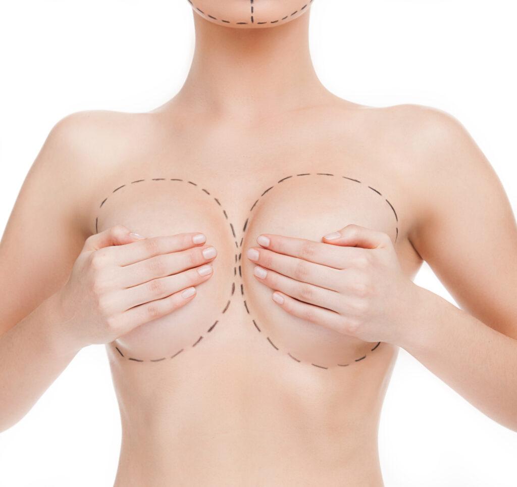 Female Breast Aesthetic